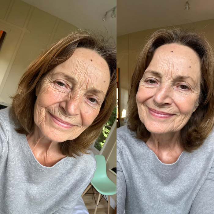 Before After Karen K. 58y