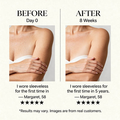 The Body Oil Formulated for Menopausal Skin Transformation - cronecauldron